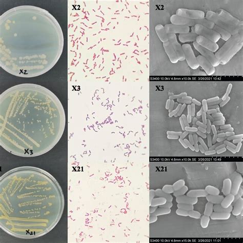 The Morphology Of The Bacterial Colonies Gram Staining By Sem × 10⁴