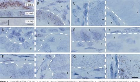 Figure 2 From Tumorigenesis And Neoplastic Progression Differential