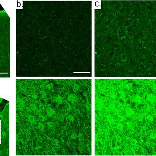 Loss Of Fbxo2 Results In Increased APP Altered APP Localization And