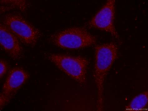 CoraLite594 PTEN Mouse Monoclonal Antibody United Bio Research