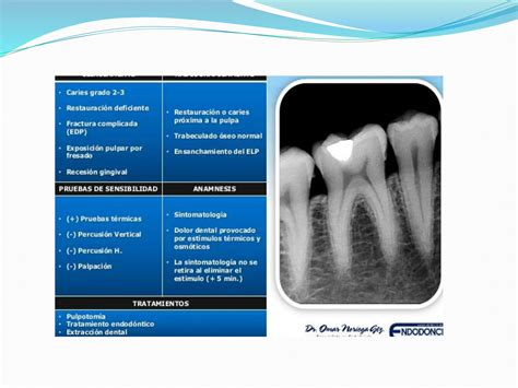 Diagnostico Pulpar Y Periapical Endo Pptx