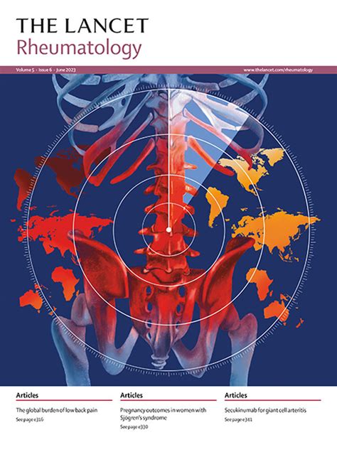 The Lancet Rheumatology June 2023 Volume 5 Issue 6 Pages E305 E362