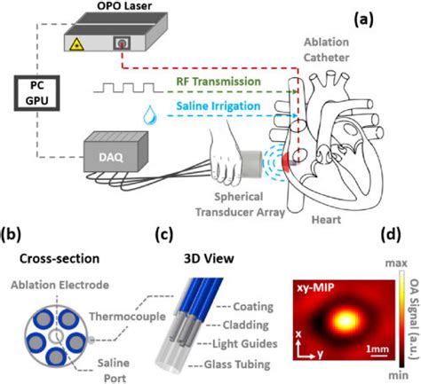 Design And Implementation Of The RF Ablation Catheter A Schematic