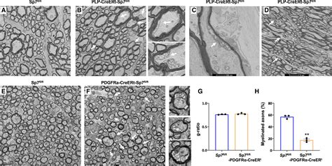 The Bone Transcription Factor Osterix Controls Extracellular Matrix