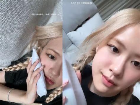 Blackpink Rose Remains Beautiful Even After Getting Her Wisdom Teeth