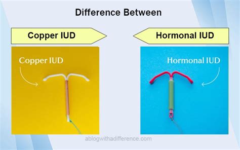 Between Copper And Hormonal Iud The Best 6 Difference