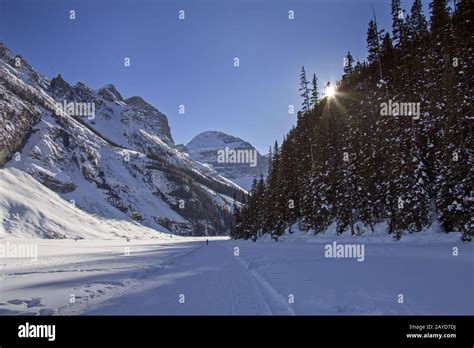 Chateau Lake Louise Stock Photo - Alamy