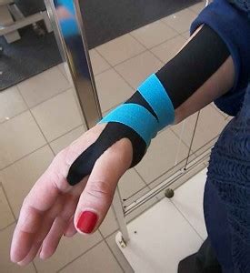 Kinesiotaping Per Tendinite Al Polso ChiroModena Chiropratica Modena