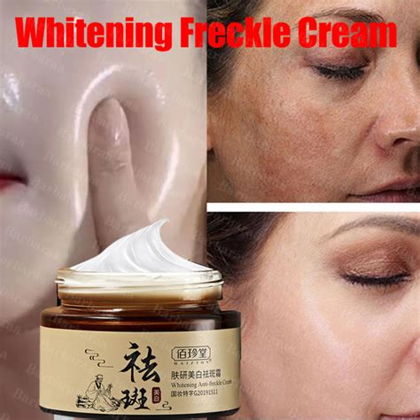 Whitening Freckle Cream For Face Melasma And Pekas Remover Cream