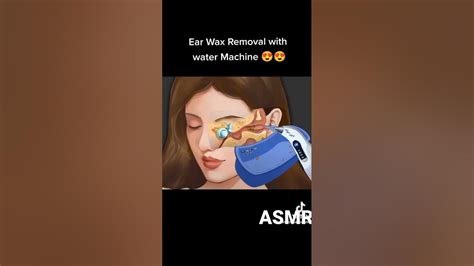 [animated Asmr]ear Wax Remove With Water Animationasmr Ytshorts Yt