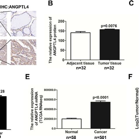 Angptl Is Highly Expressed In Thyroid Cancer Compared With Adjacent