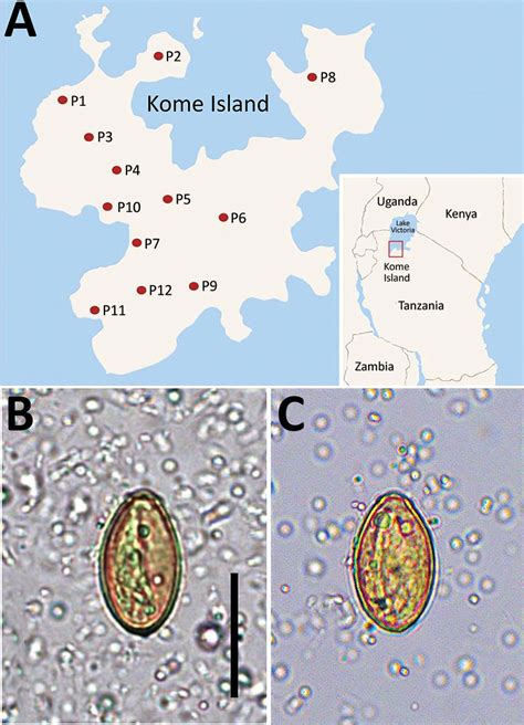 Figure 1 Molecular Detection Of Haplorchis Pumilio Eggs In