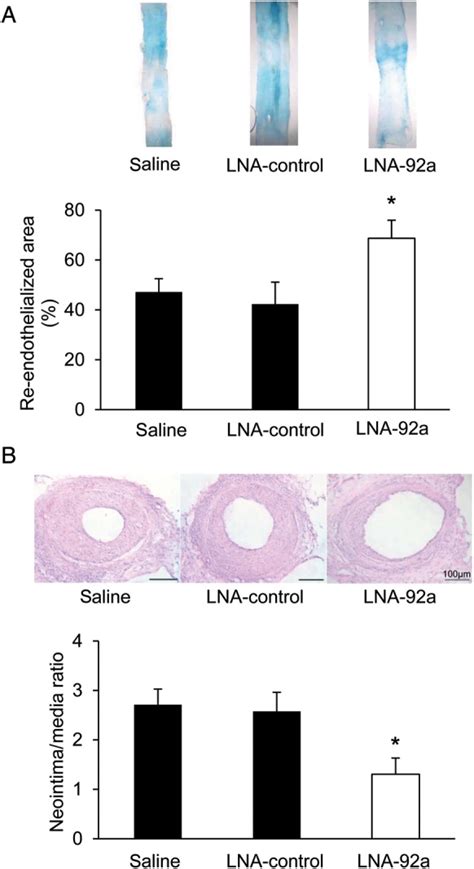 Enhanced Re Endothelialization After Targeting Mir 92a A Evans Blue