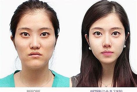 kandeej.com: 20 Almost Unrecognizable Plastic Surgery Before & Afters ...