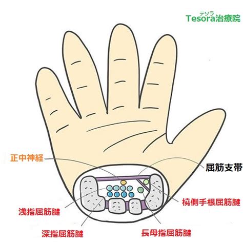 手のしびれ【手根管症候群】原因とストレッチ テソラ治療院：名古屋市千種区