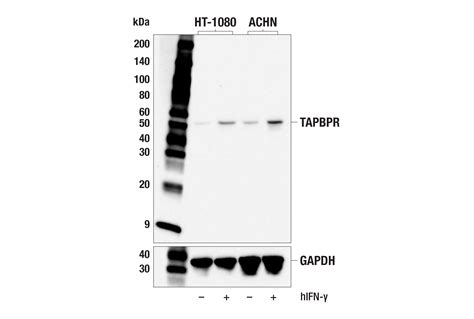 TAPBPR E5P1F Rabbit MAb Cell Signaling Technology