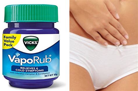 Vicks Vagina Treatment Royal College Of Obstetricians Warn Against