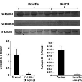 Expression Of Tgf In Burn Tissues A Western Blot Analysis For The