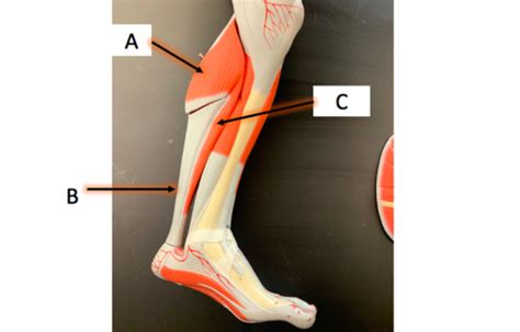 Muscles Arms And Legs 1 Flashcards Quizlet