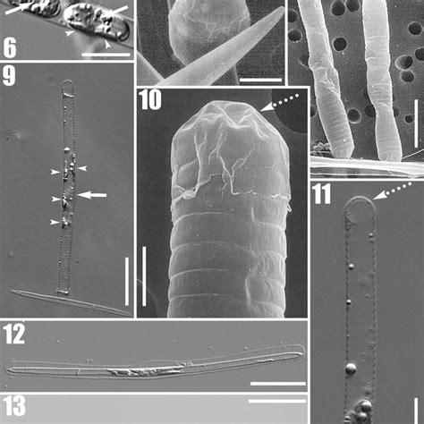 Pdf Morphology Phylogeny And Sexual Cycle Of Pseudo Nitzschia