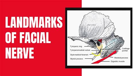 Landmarks Of The Facial Nerve Youtube