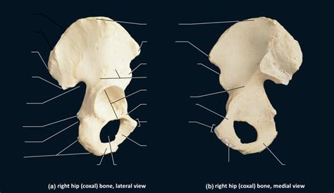 Sacrum Diagram Quizlet