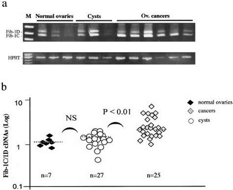 Expression Of Fibulin 1C And 1D CDNAs In Normal Ovaries As Compared To