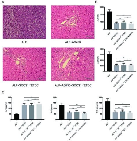 AG490 Or SOCS1 ETDCs Protect Against Liver Injury Induced By