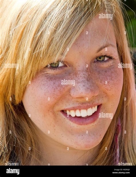 Adolescent Avec Des Taches De Rousseur Banque De Photographies Et D