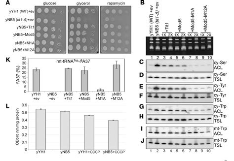 Figure From Lack Of Trna I A Modification Causes Mitochondrial Like