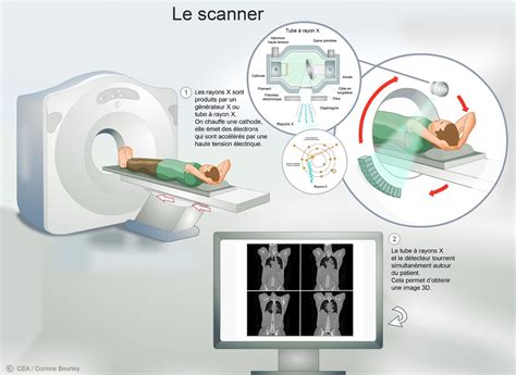 Découvrir Comprendre L imagerie médicale