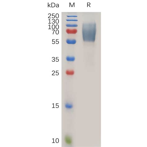 Human EMCN Protein hFc Tag 专注肿瘤免疫