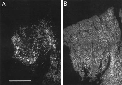 A, photomicrographs of a section from SCC tumor tissue cube (patient... | Download Scientific ...