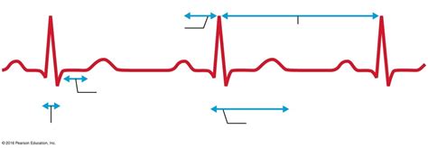 The Electrocardiogram Diagram Quizlet