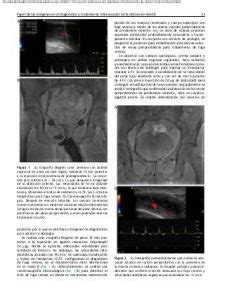 C Mo Se Pueden Identificar Las Fugas Venosas En El Pene Fuga Venosa