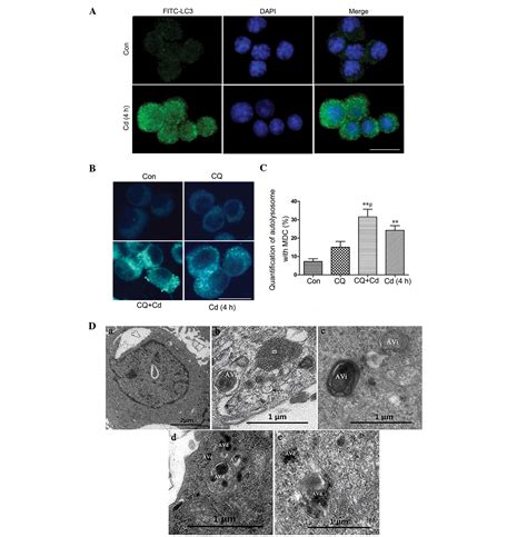 Cadmium Induced Autophagy Is Mediated By Oxidative Signaling In PC 12