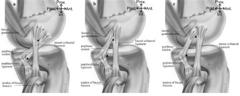 Popliteus Origin And Insertion