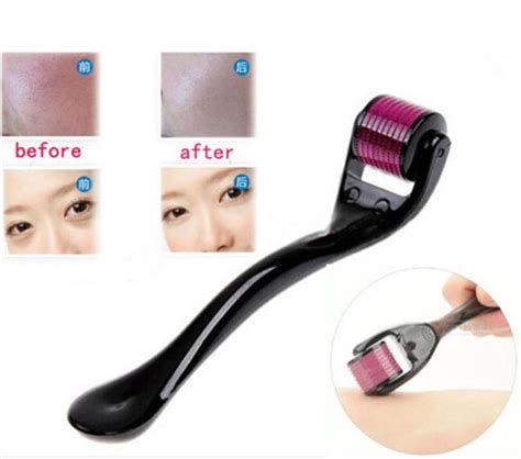 Derma Roller system in pakistan 0321-7608791