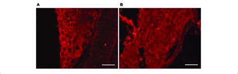 MβCD disruption of lipid rafts in DRG neurons A B Representative