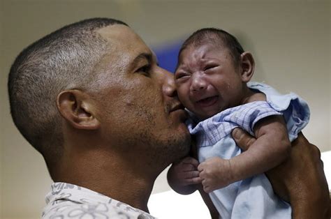 Estas desgarradoras imágenes muestran los efectos del virus zika