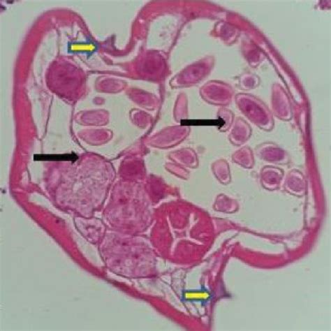 Histology Specimen Oblique Cut Of Enterobius Vermicularis Located In Download Scientific