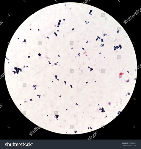 Smear Human Blood Culture Grams Stained Stock Photo Edit Now