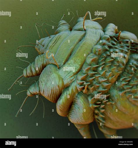 A Close Up View Of The Cause Of Scabies The Mite Sarcoptes Scabiei