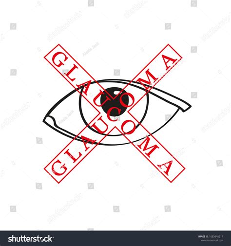 Disease Icon Glaucoma Stock Vector Royalty Free 1083648617 Shutterstock