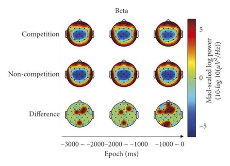 Scalp Maps Representing Theta A Alpha B And Beta C Power During