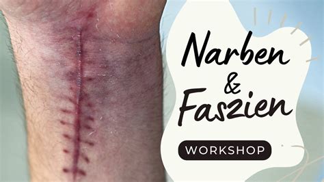 Workshop Narben Faszien Youtube