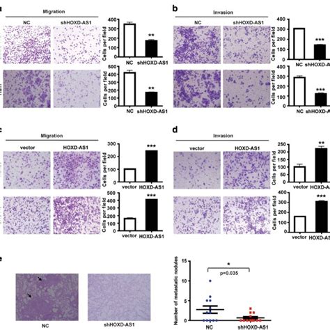 Hoxd As1 Promotes Invasion And Metastasis Of Hcc Cells In Vitro And In