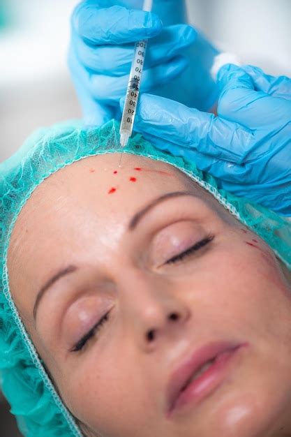 Traitement du visage par injection de Prp traitement du visage anti âge