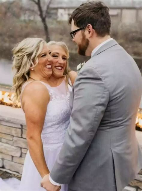 Did Abby & Brittany Hensel's Unique Condition Contribute To Their Deaths? The Shocking Truth Image 9