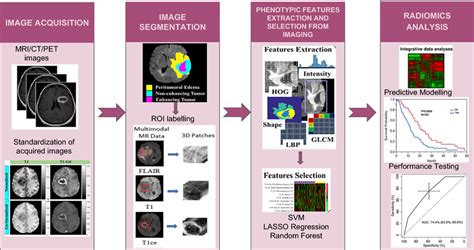 Pipeline Showing Radiomics Workflow Acquired Clinical Images Are Download Scientific Diagram